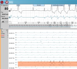 Holter EKG CARDIOLIGHT