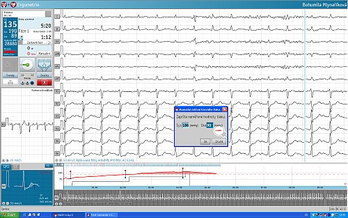 Ergometrický systém FLASHLIGHT ERGO - záznam EKG křivky