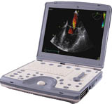 Ultrazvuk GE Vivid i